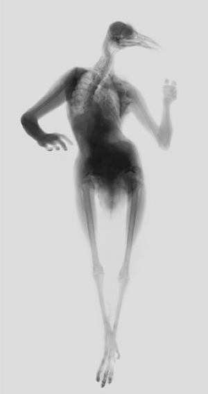 Illustration for article titled Hybrid X-ray images of bird people and octopus women